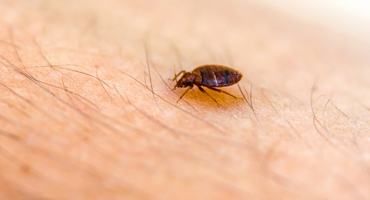 Bed Bug Bites