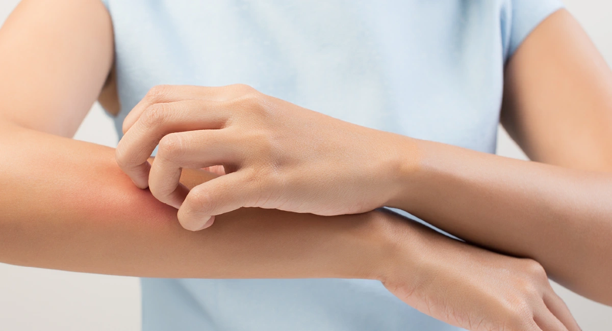 woman scratching her arm